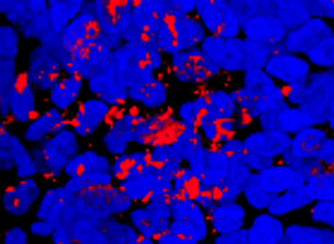 Immagine diNuovo approccio contro le infezioni nella fibrosi cistica